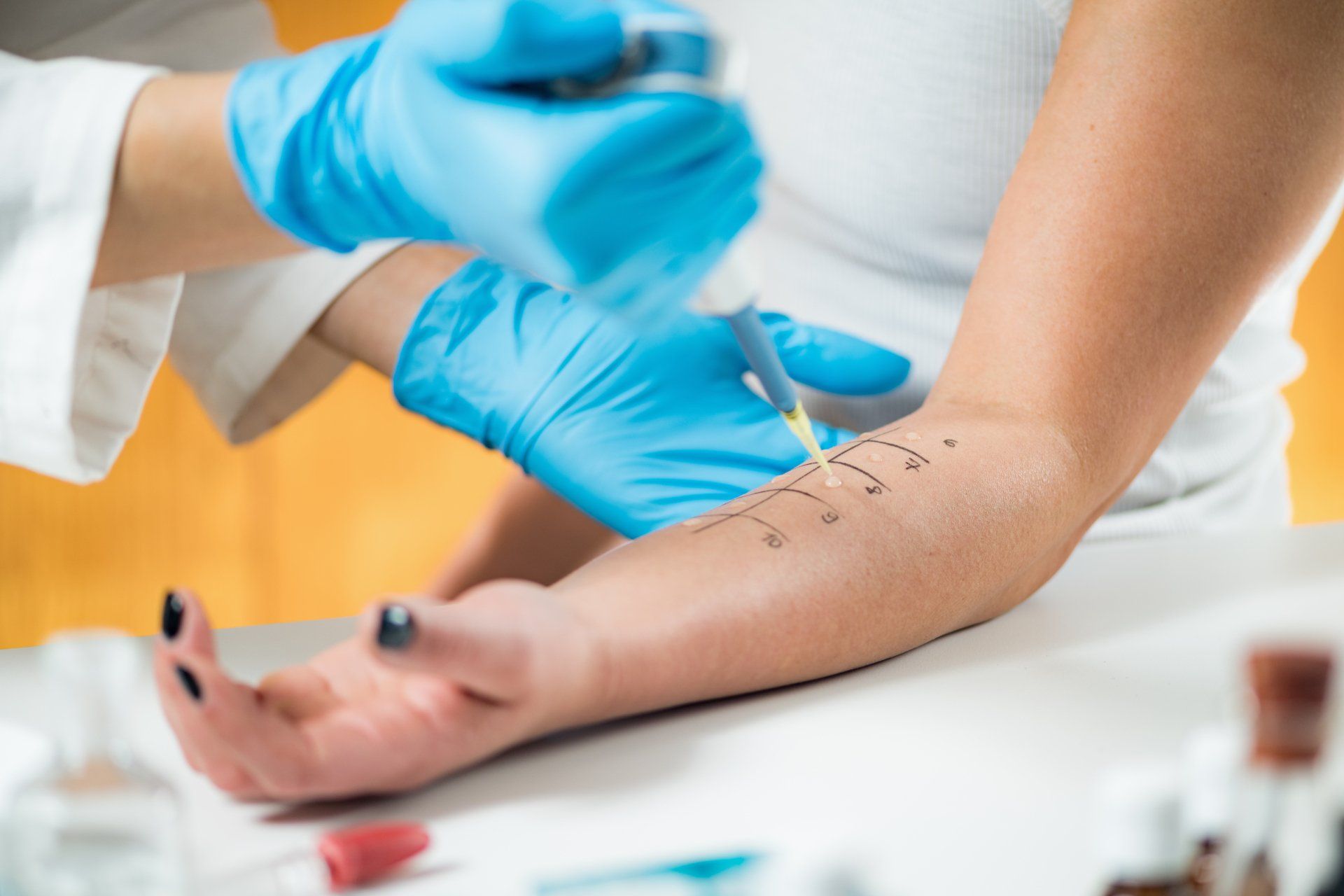 Penicillin Allergy Testing - Lakewood Ranch