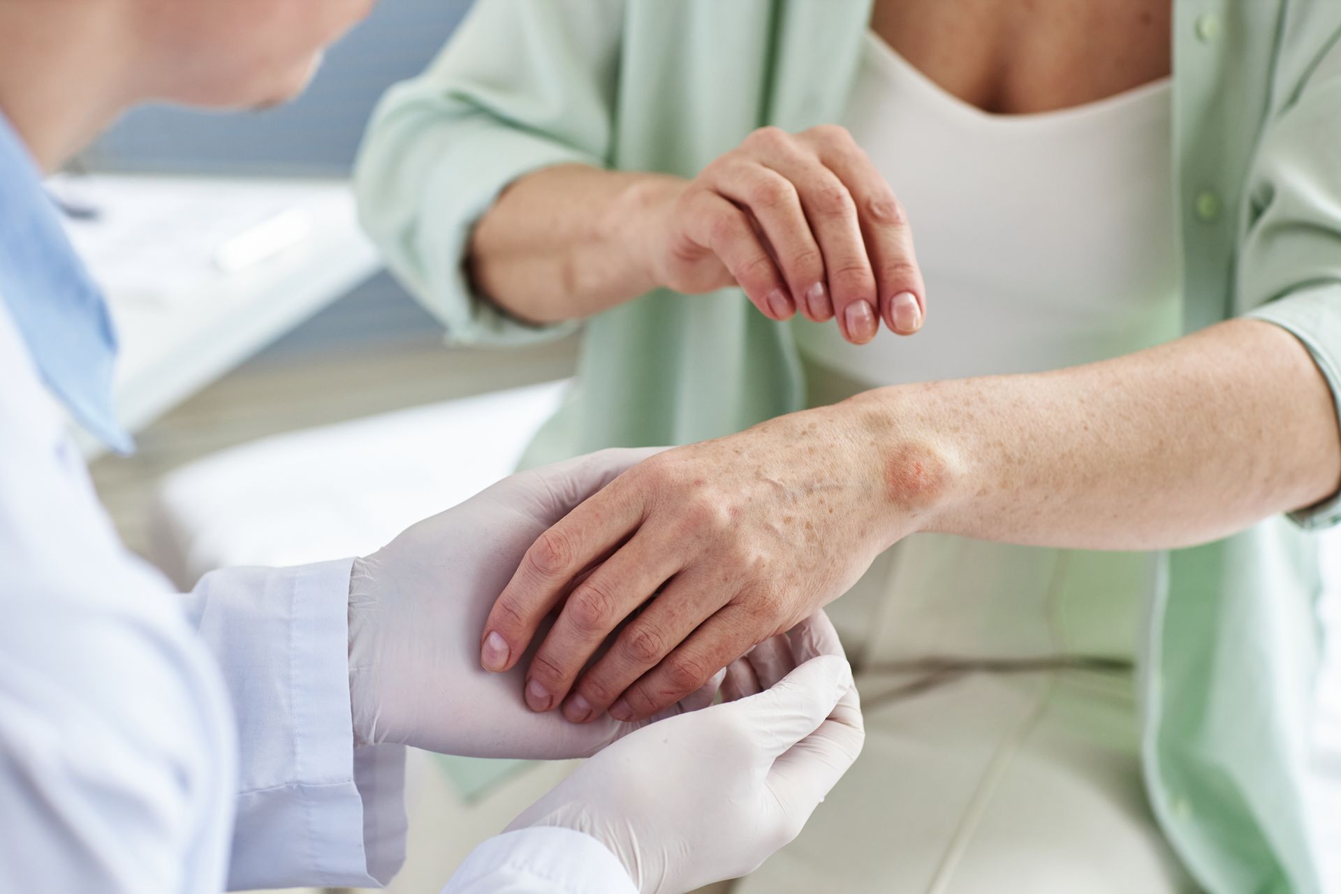 Common Causes of Contact Dermatitis and How to Manage Them