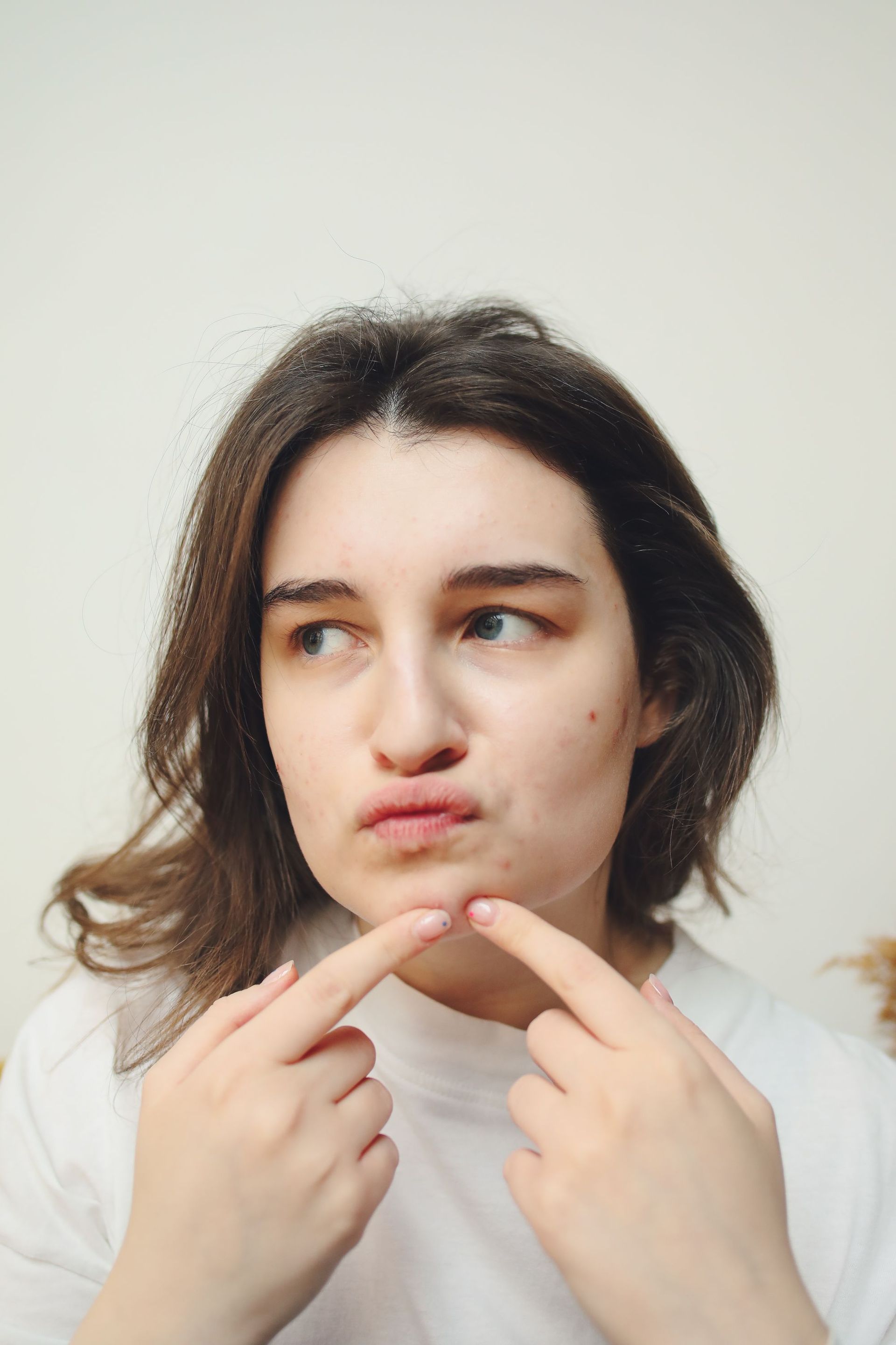 points noirs sur le visage