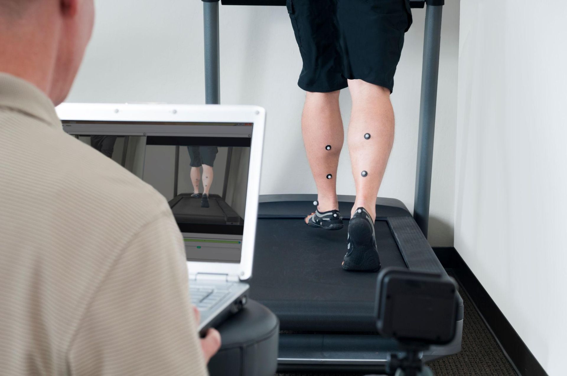 Physical therapy assessment with leg markers on a person walking on a treadmill as a clinician observes from a laptop