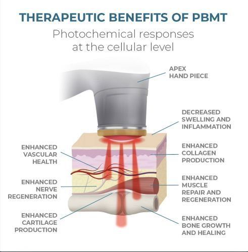 PBMT benefits diagram showing red light treatment on knee with labels for healing and reduced inflammation