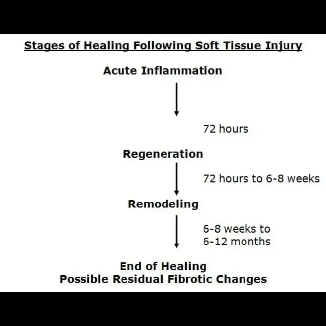Flowchart of soft tissue injury healing stages: acute inflammation, regeneration, remodeling, possible residual fibrosis