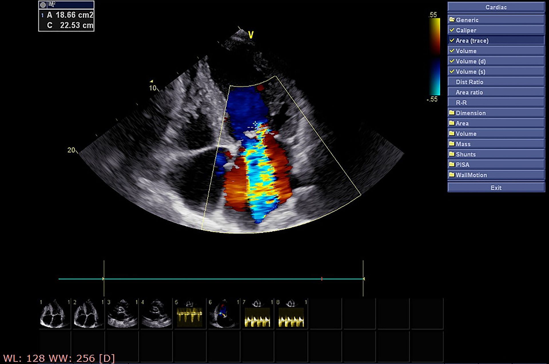 Eco-Cardio Color Doppler
