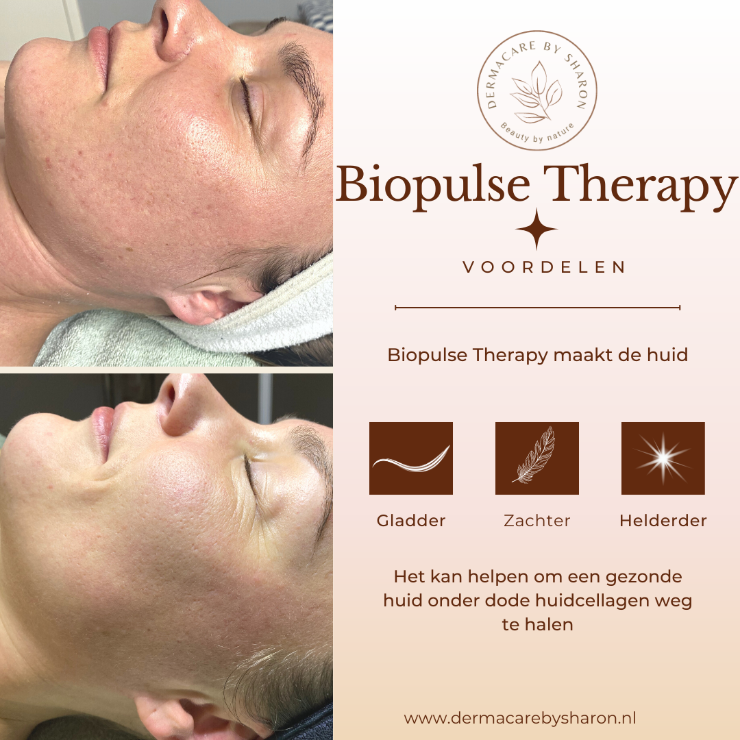 Huidverbetering Biopulse