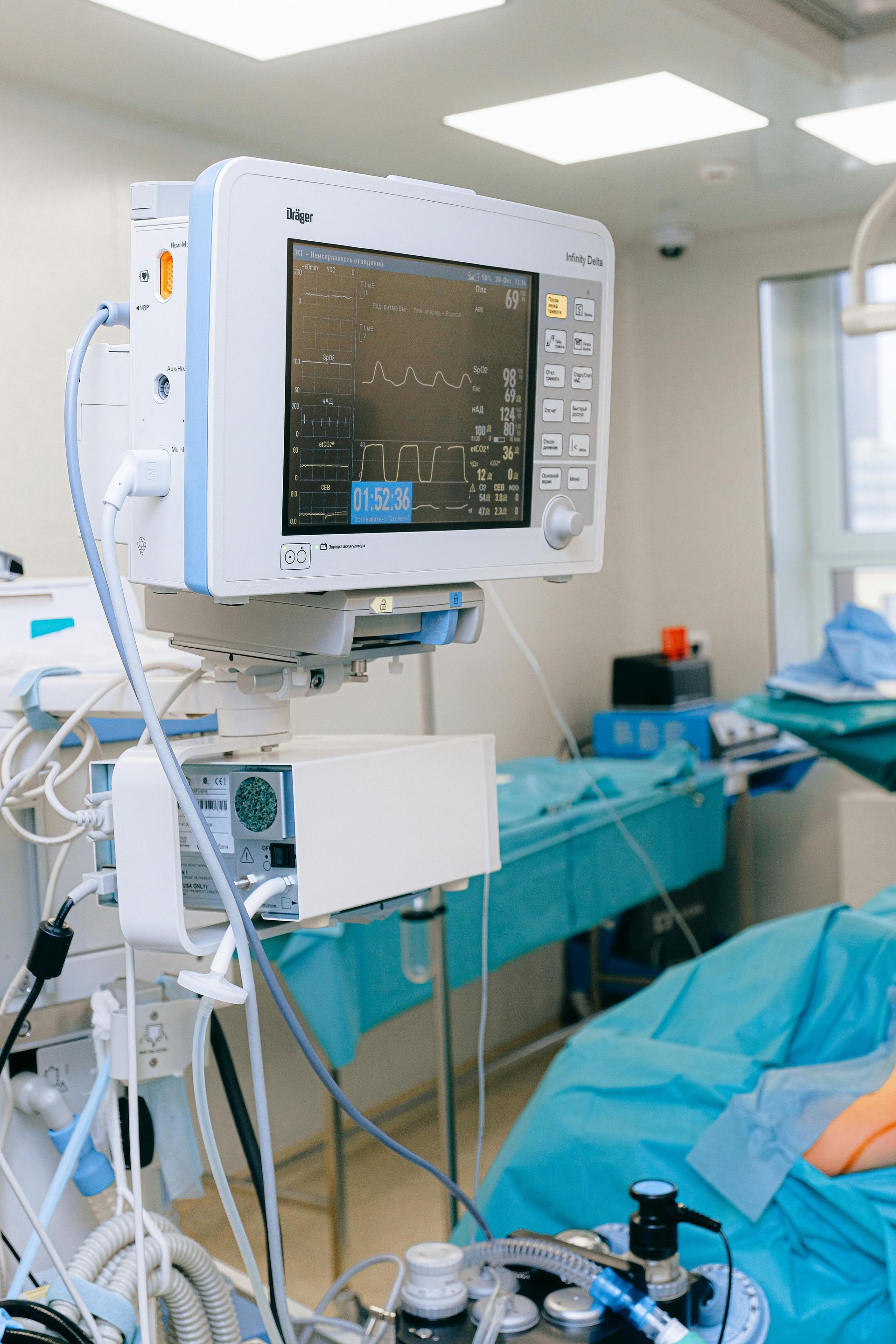 Medical monitor in an operating room displaying vital signs with surgical equipment and blue draped patient bed.