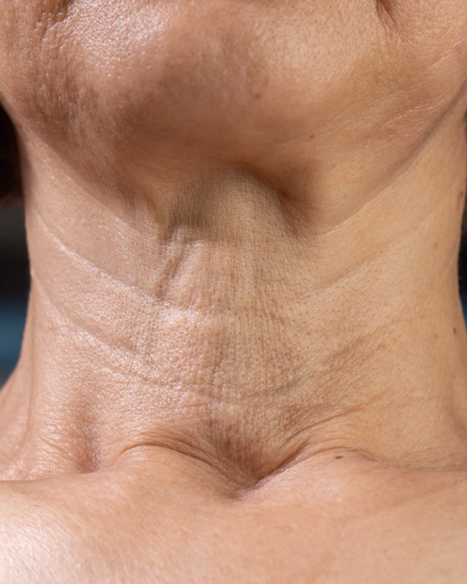 Nahaufnahme der Haut am menschlichen Hals, mit sichtbaren horizontalen Halsfalten und detaillierter Hautstruktur.