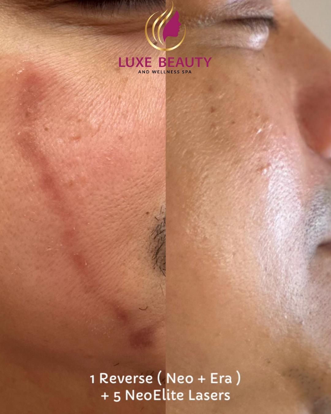 Under eye area showing fine lines and uneven skin texture