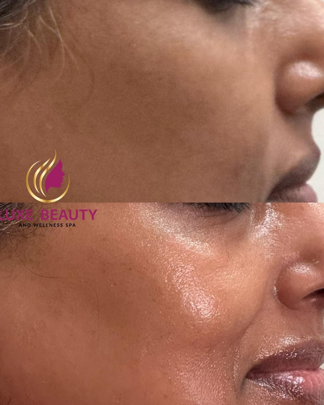 Side profile of face showing smooth skin texture and even tone