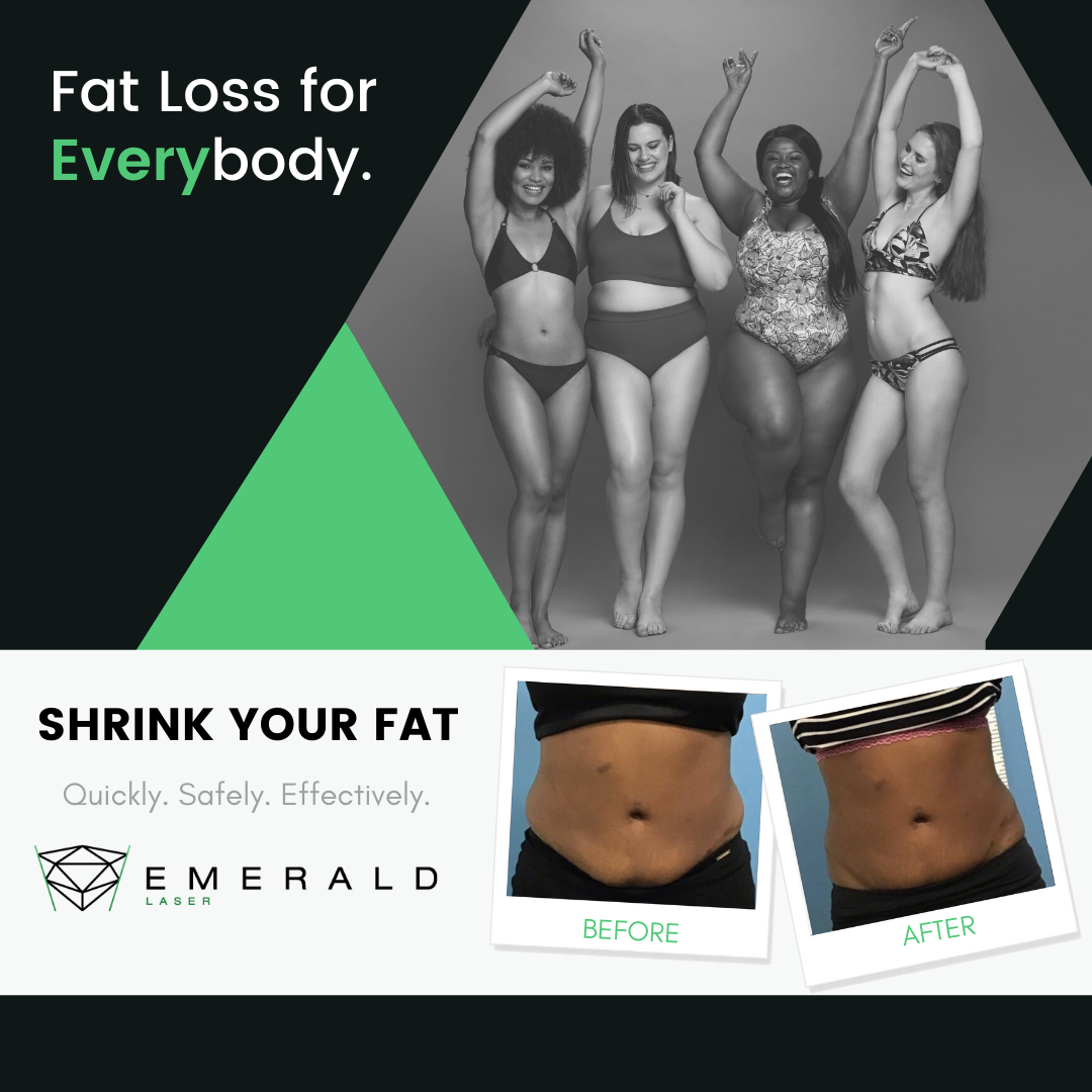 Emerald laser fat loss treatment results for body contour improvement