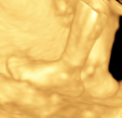 Imagen ecográfica de color dorado del rostro de un feto de perfil.