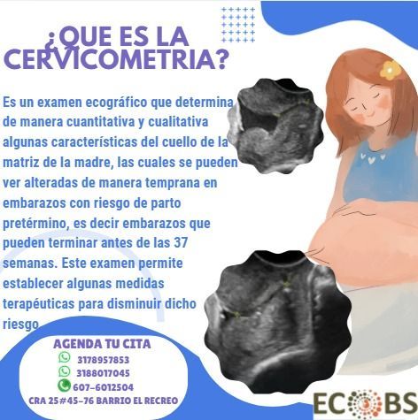 Infografía en español sobre cervicometría, con texto explicativo, ecografías y agenda de cita médica.