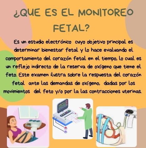Infografía en tonos pastel sobre el monitoreo fetal, con título y dibujos de una embarazada conectada a monitores.