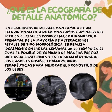 Infografía en español sobre la ecografía de detalle anatómico, con texto explicativo y cuatro imágenes fetales/ecográficas.