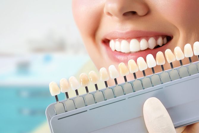 Primo piano di una bocca sorridente con una scala cromatica dei denti tenuta vicino ai denti.