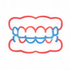 Illustrazione schematica di denti superiori e inferiori con gengive rosse e apparecchio blu, visti frontalmente.