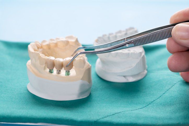 dentist showing patient xrays