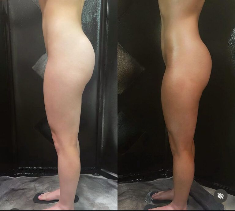 Side-by-side profile views of a person’s bare legs and torso in a dark studio setting