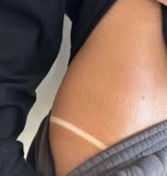 Close-up of a person’s thigh in black shorts with a white strap tan line