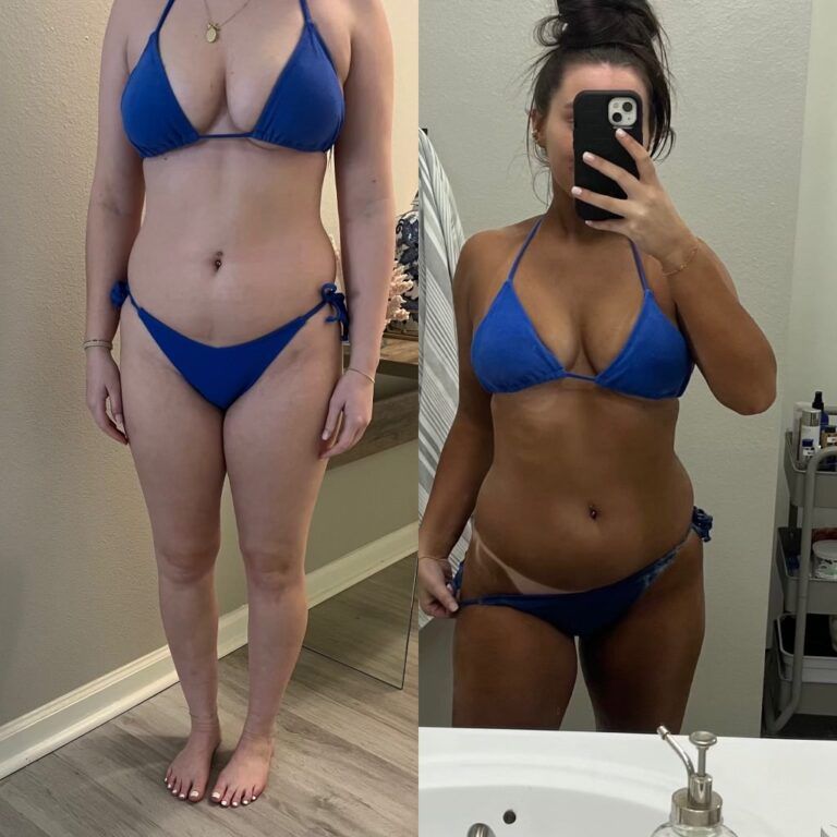 Before-and-after mirror photo of a person in a blue bikini, showing body transformation.