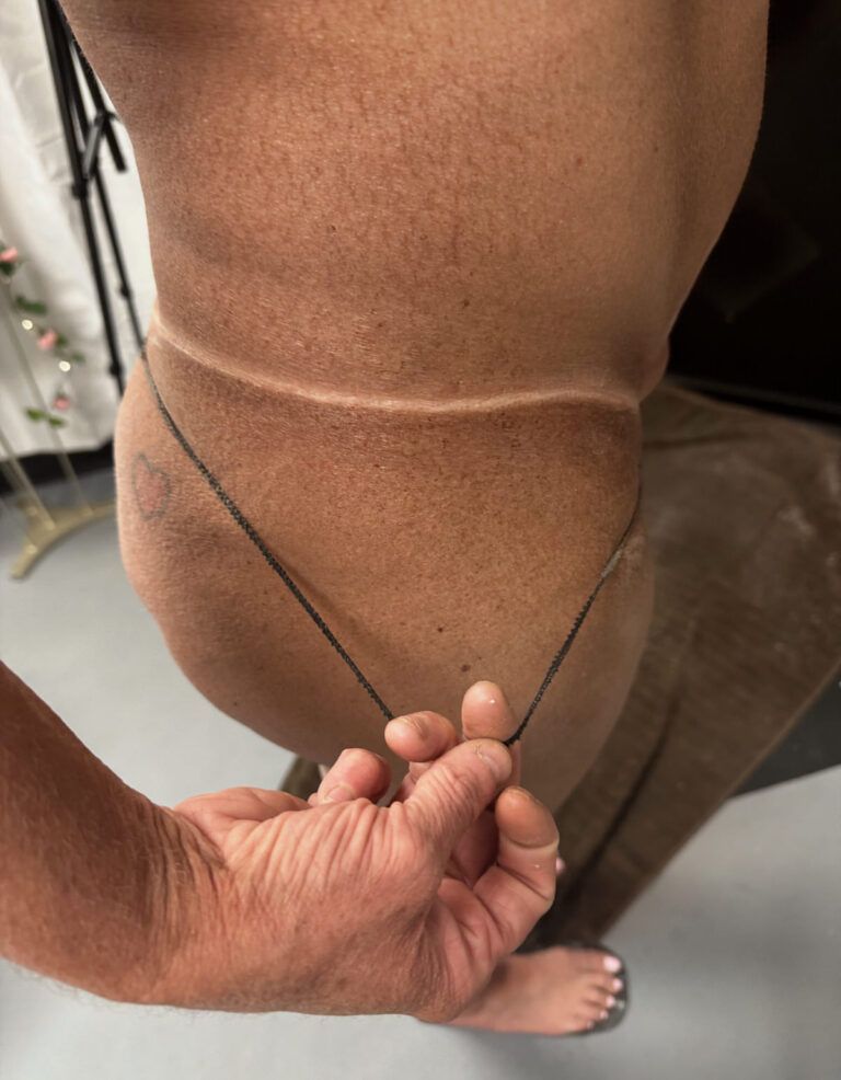 Hand pulling a black cord loop around a person's bare thigh against a gray floor