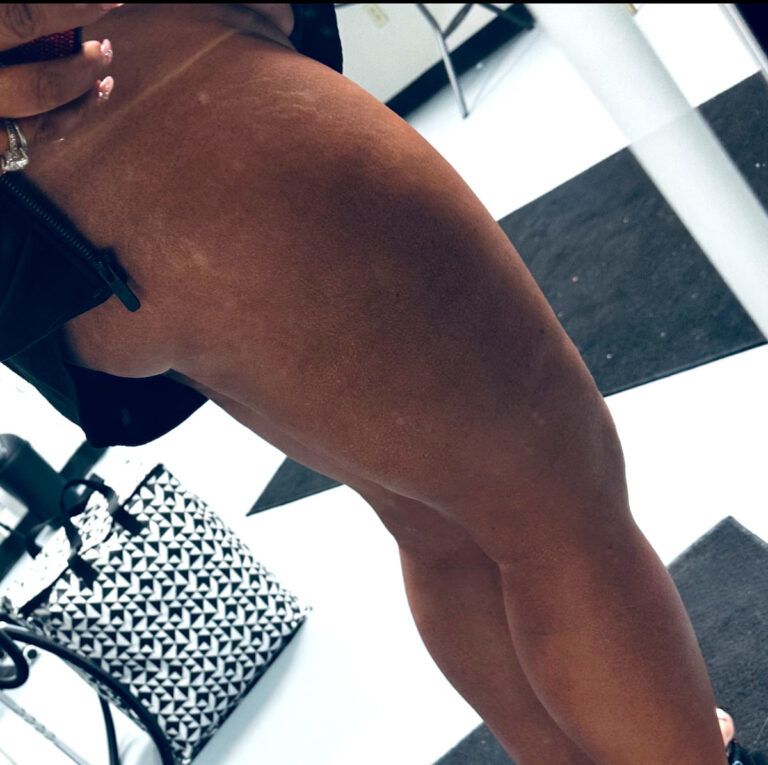 Close-up of a person’s tanned leg in black shorts, standing on a black-and-white tiled floor.