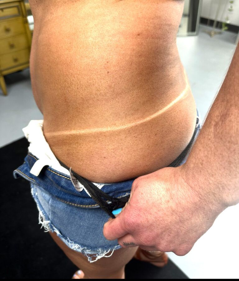 Close-up of a person’s exposed abdomen with a hand pulling down blue jeans and shorts.