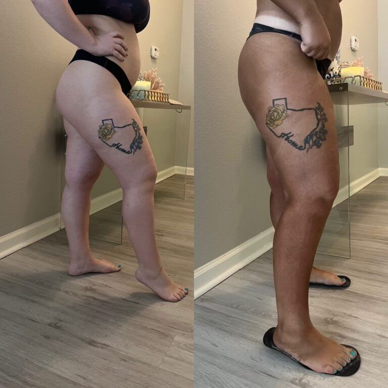 Side-by-side photos of a person in black underwear showing a thigh tattoo, standing in a room.