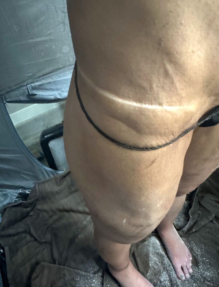 Close-up of a person’s bare legs and feet standing indoors on a dark blanket