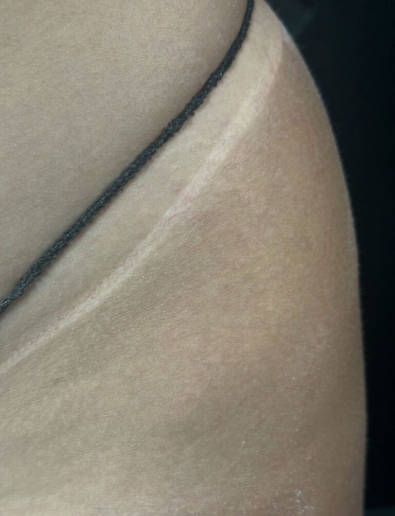 Close-up of skin with a thin black strap along the edge and a white reflective streak.