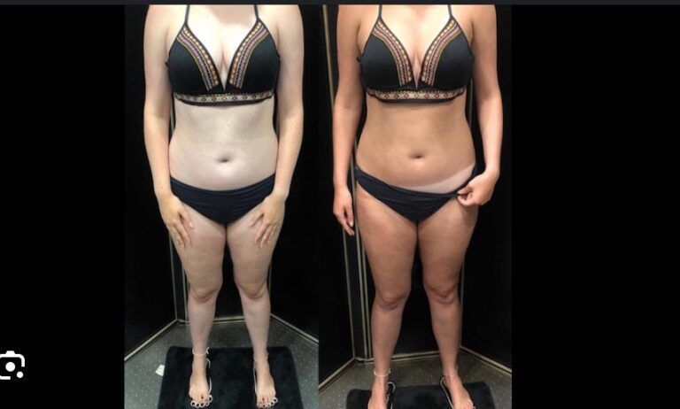 Side-by-side front view of a woman in black lingerie, showing a slimmer waist and fuller figure contrast.