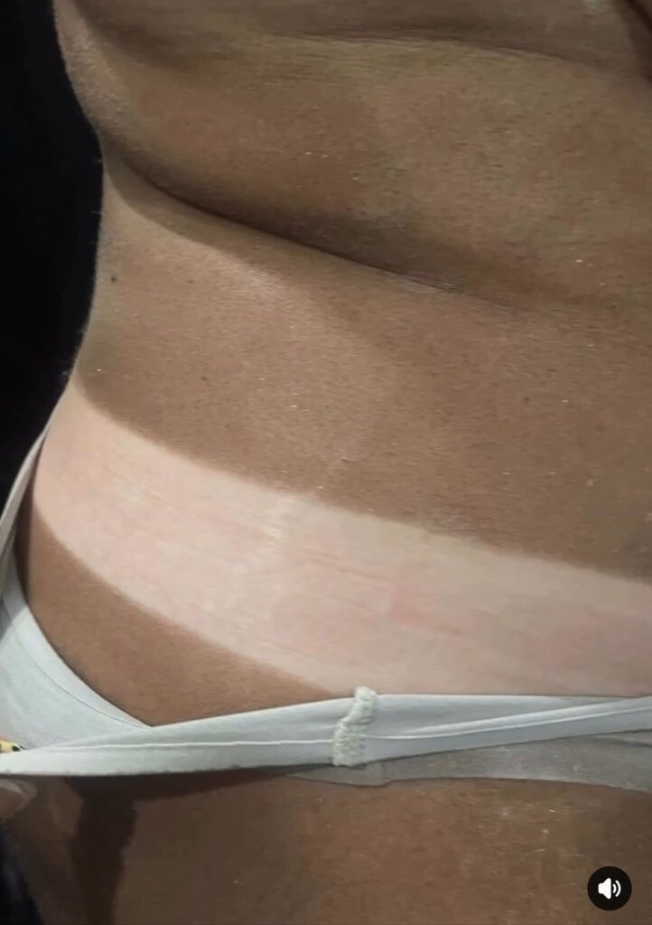 Close-up of a torso with a white waistband and visible skin folds against a dark background