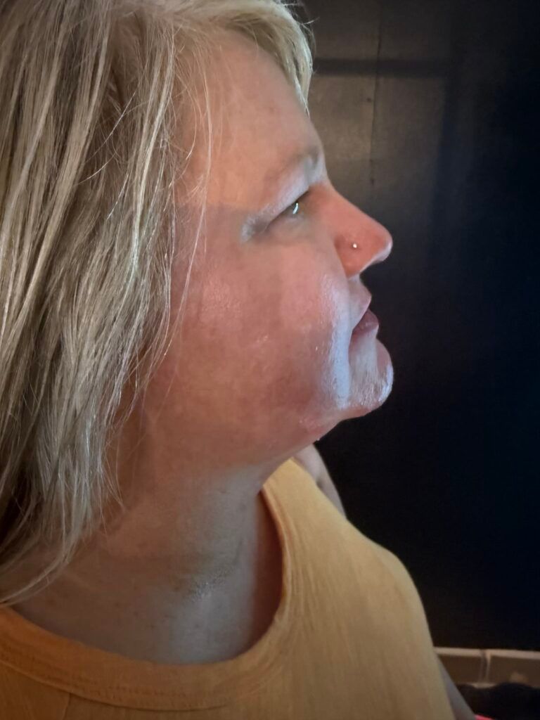 Profile of a blonde woman in a yellow top, looking to the right against a dark background