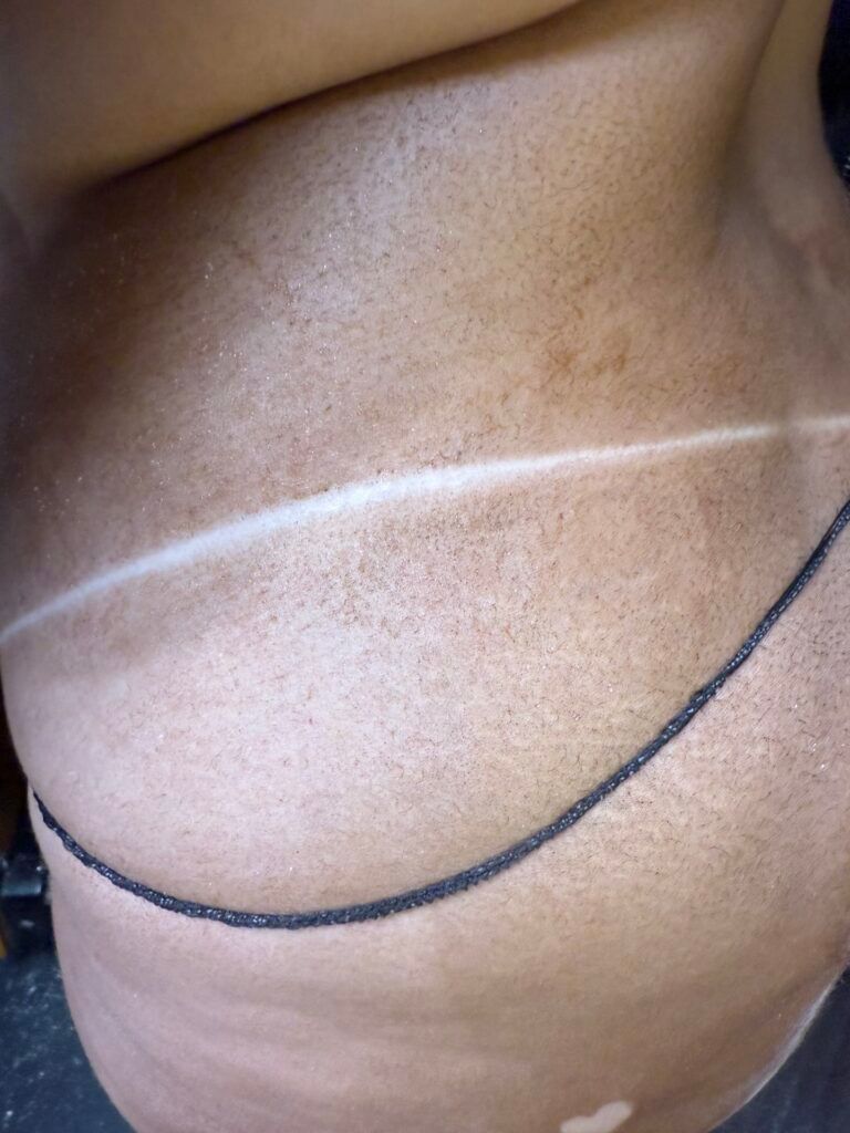 Close-up of a bare torso with a white tan line and a black strap across the side