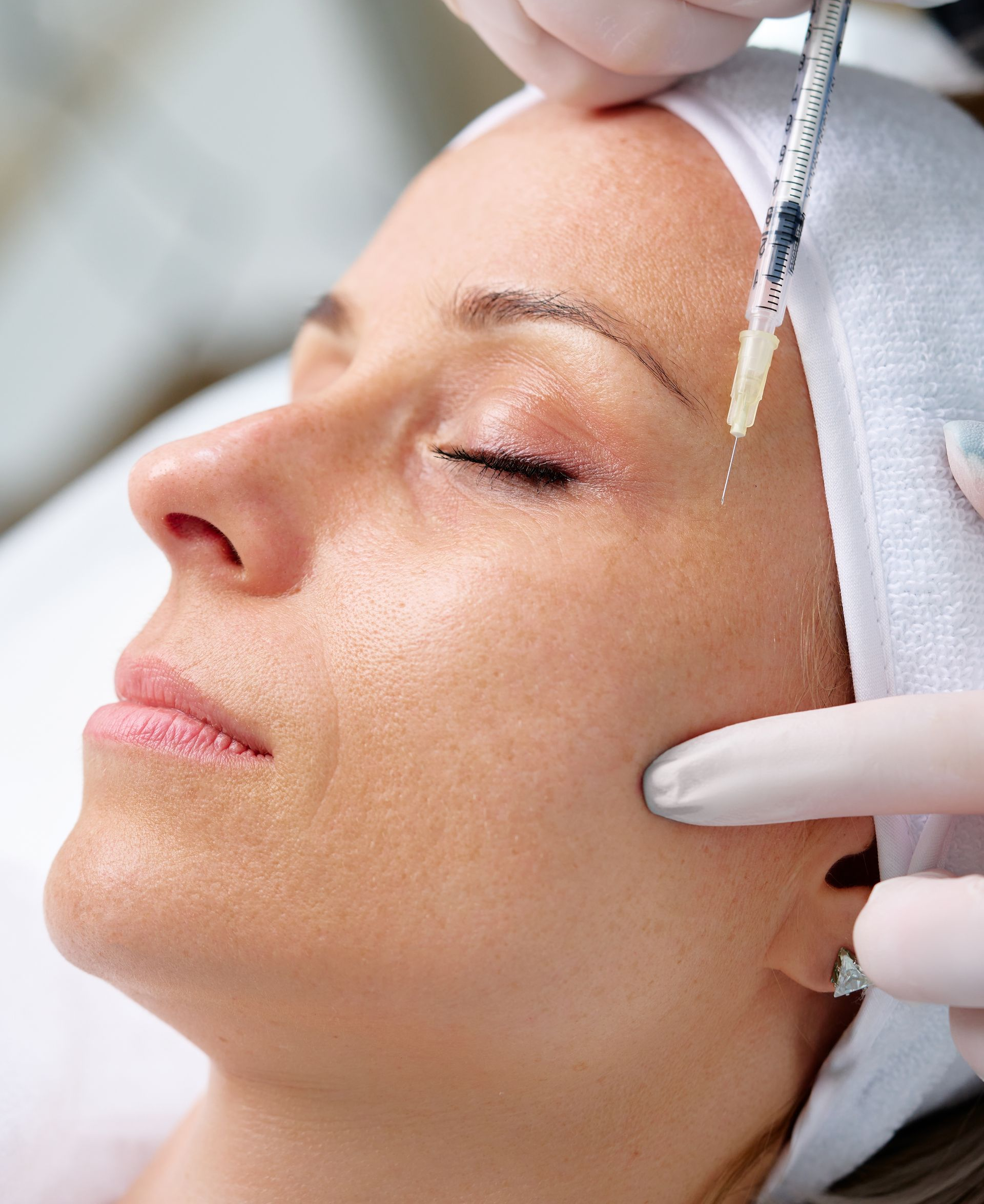Cosmetic facial treatment on a woman with eyes closed, gloved hands applying a tool near her temple