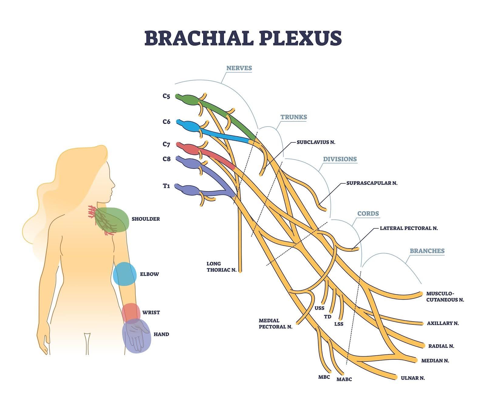 Diagrama de los nervios del plexo braquial con la silueta de una persona que muestra la distribución de los nervios en el brazo.