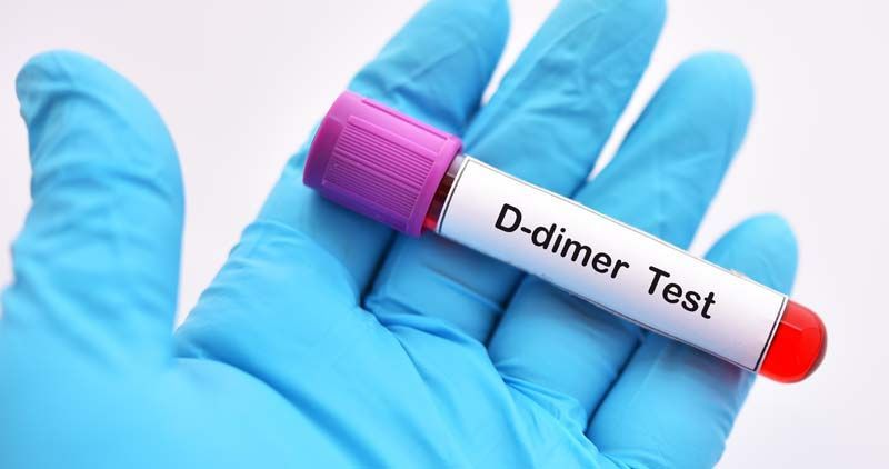Gloved hand holding a blood sample tube labeled