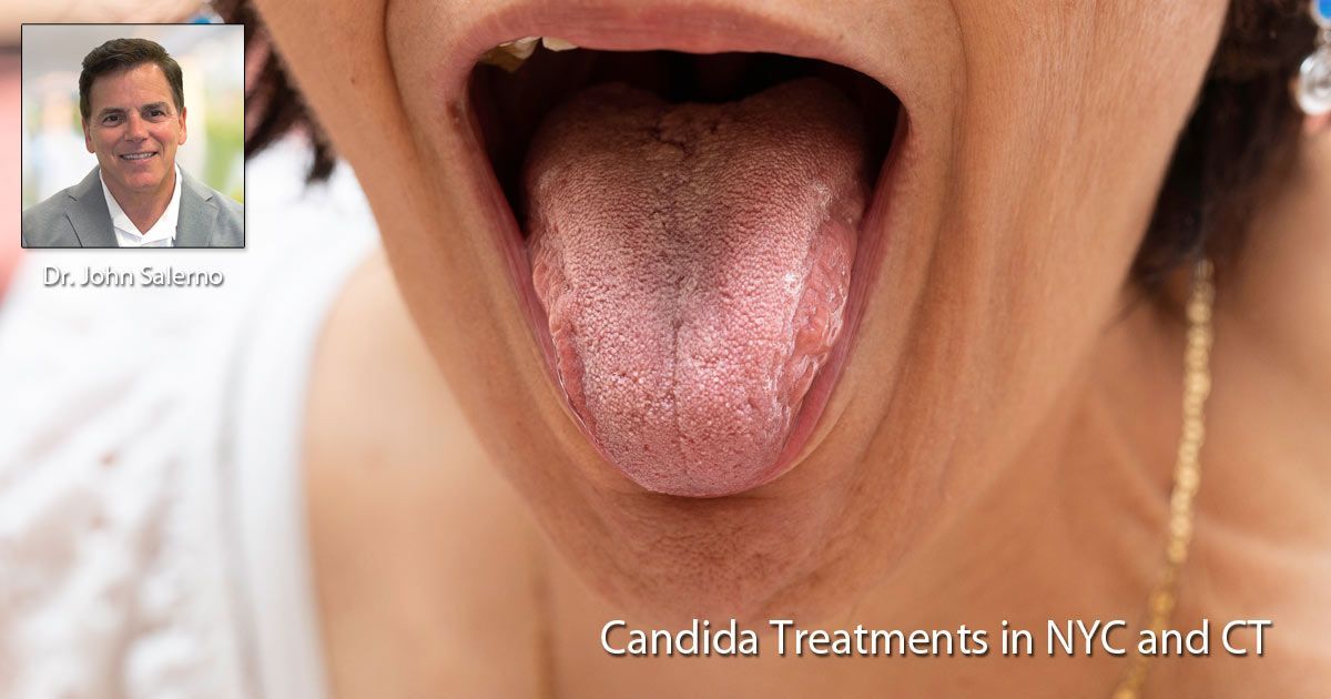 Candida Treatments NYC