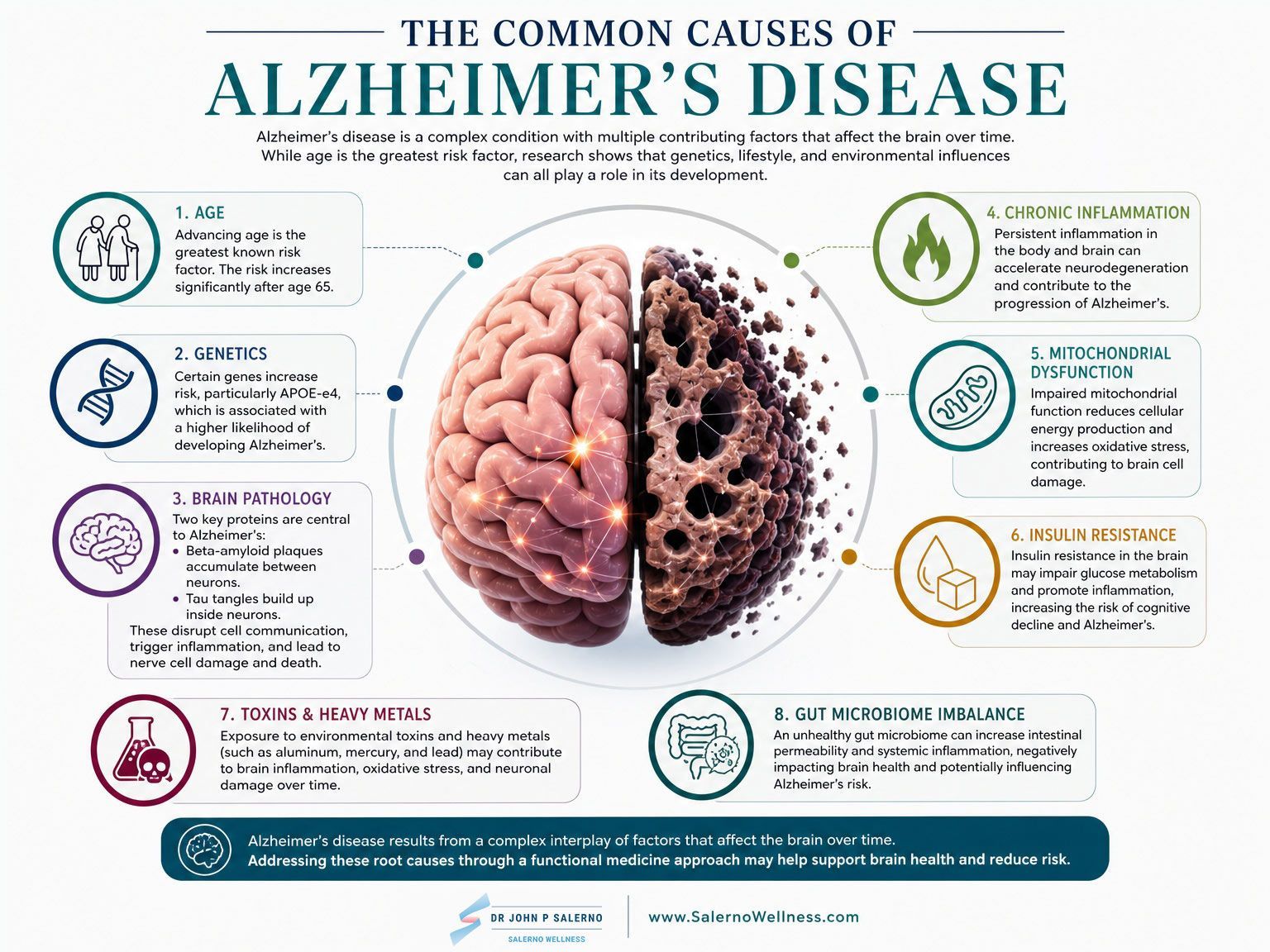 Infographic on common causes of Alzheimer’s disease, with a brain illustration and labeled causes around it