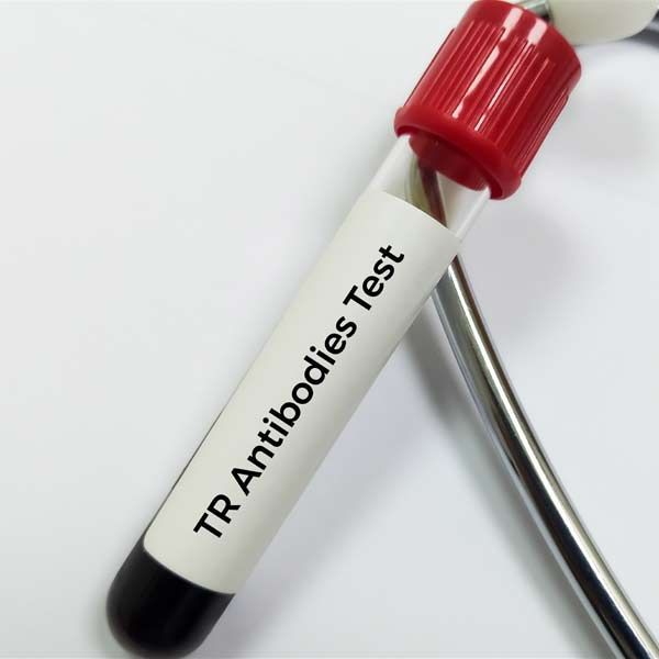 A test tube that says tr antibodies a sign the patients needs Functional and Integrative Medical Treatments for Graves' Disease at Salerno Wellness in Manhattan, NY and Connecticut
