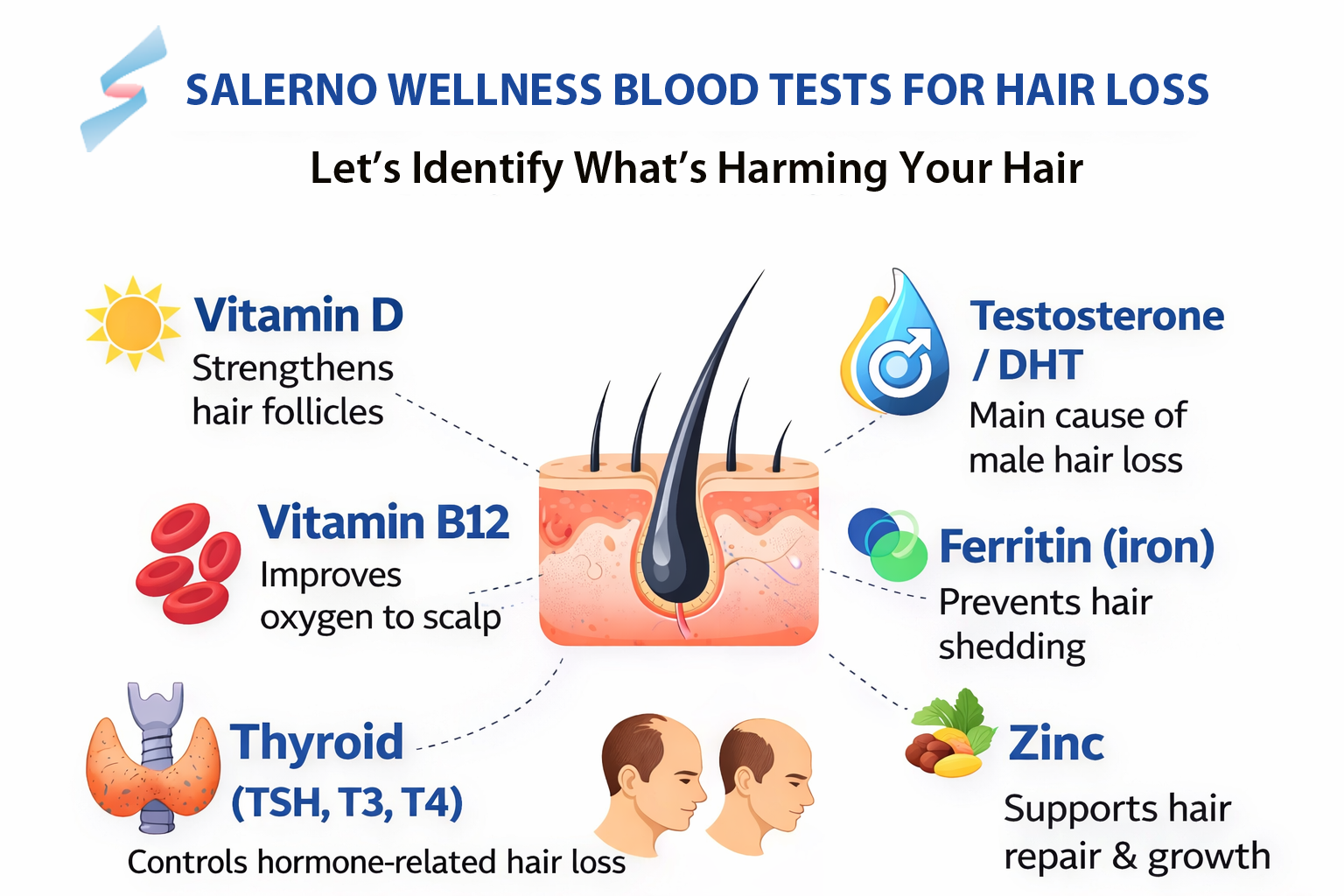 Infographic on blood tests for hair loss, listing vitamin D, B12, thyroid, testosterone/DHT, ferritin, and zinc.