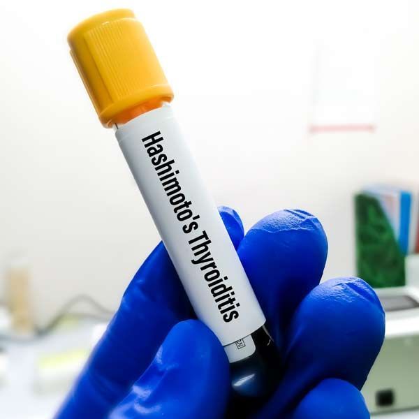 Person in blue gloves holds a blood sample tube labeled