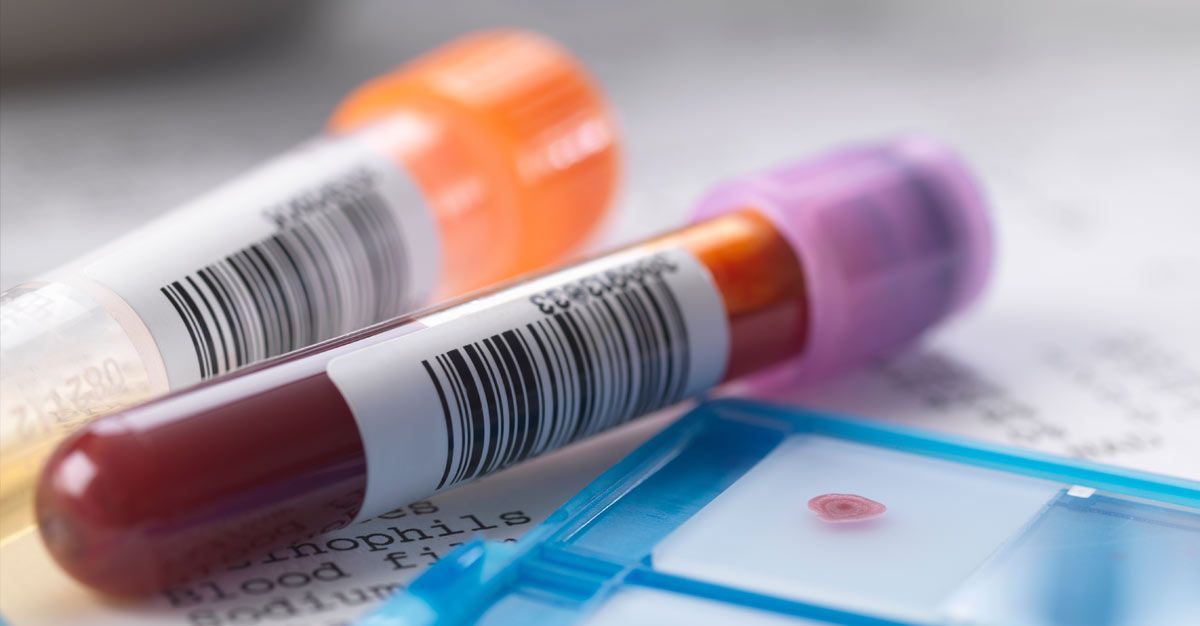 Blood sample tubes and a blue test tray on a white surface