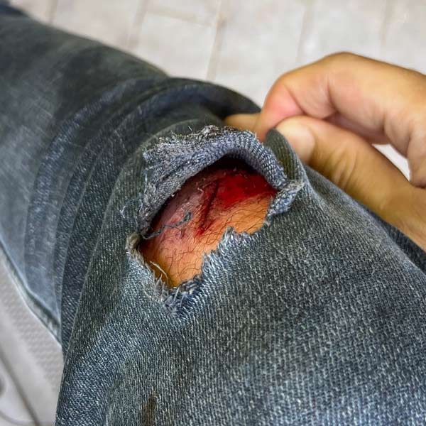 A mans Leg with a deep cut needing Mobile Wound Care