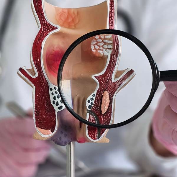 Magnifying glass close-up of the colon from cancer for colon cancer screening