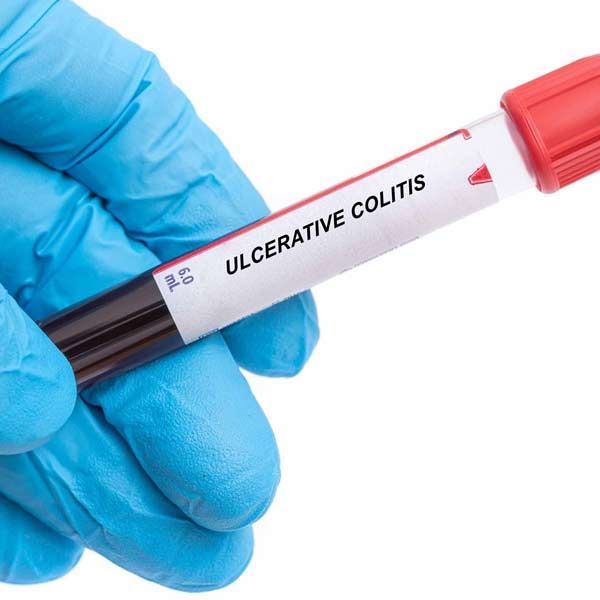 Gloved hand holding blood vial labeled