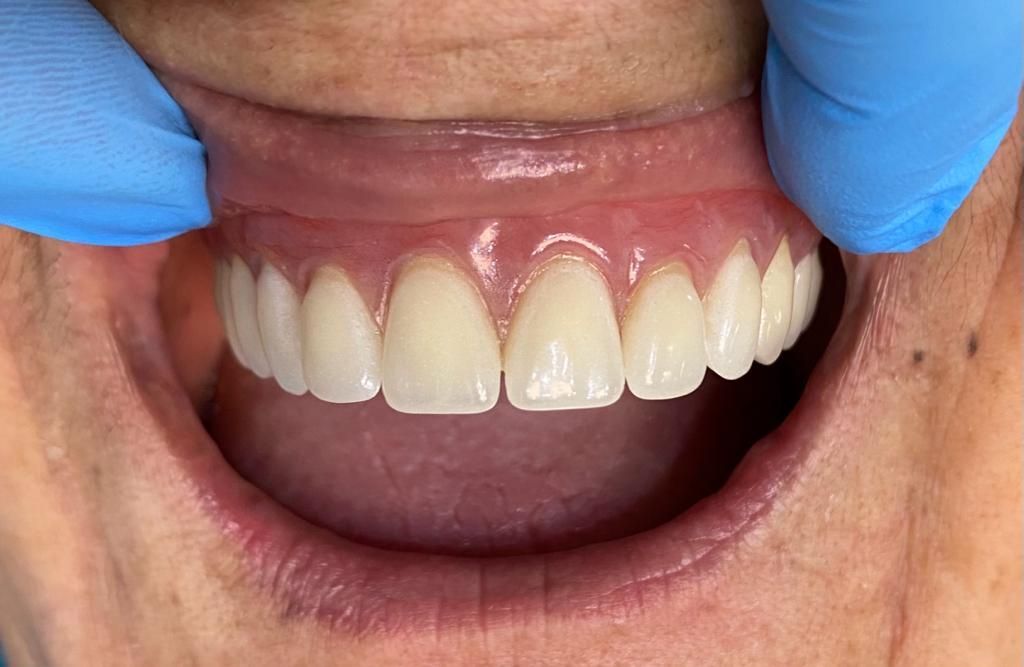 clinicadental-cys