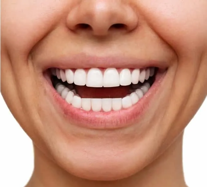 A close up of a woman 's smile with white teeth