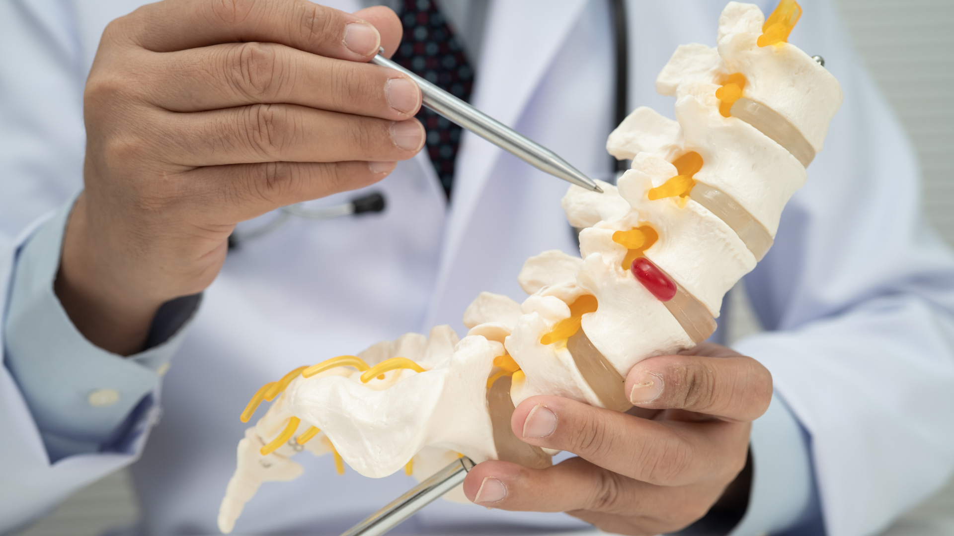 Doctor pointing to a spine model with a tool, showing colored herniated discs