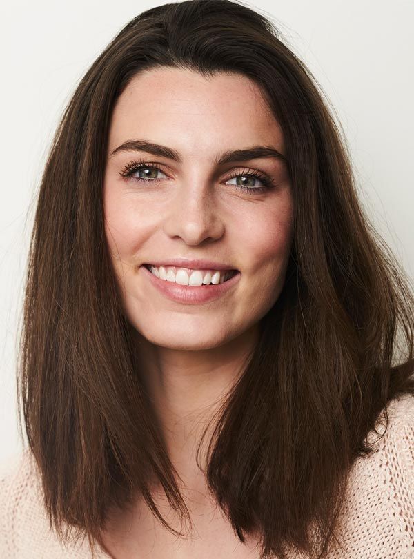 a women with excellent results from laser skin resurfacing treatment