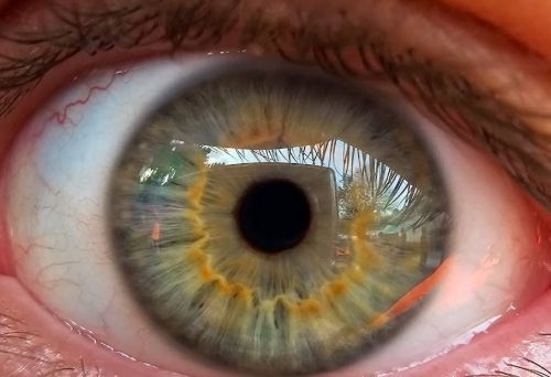 Close up image of an eye